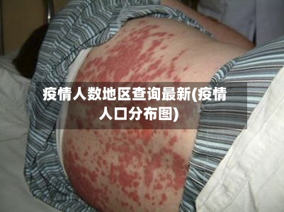疫情人数地区查询最新(疫情人口分布图)